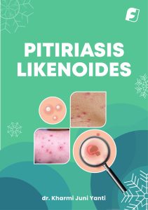 PITIRIASIS LIKENOIDES Karya dr. Kharmi Juni Yanti di Penerbir Filosofis Indonesia Press.